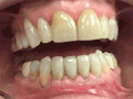 Zoomed in Image of a Set of Teeth